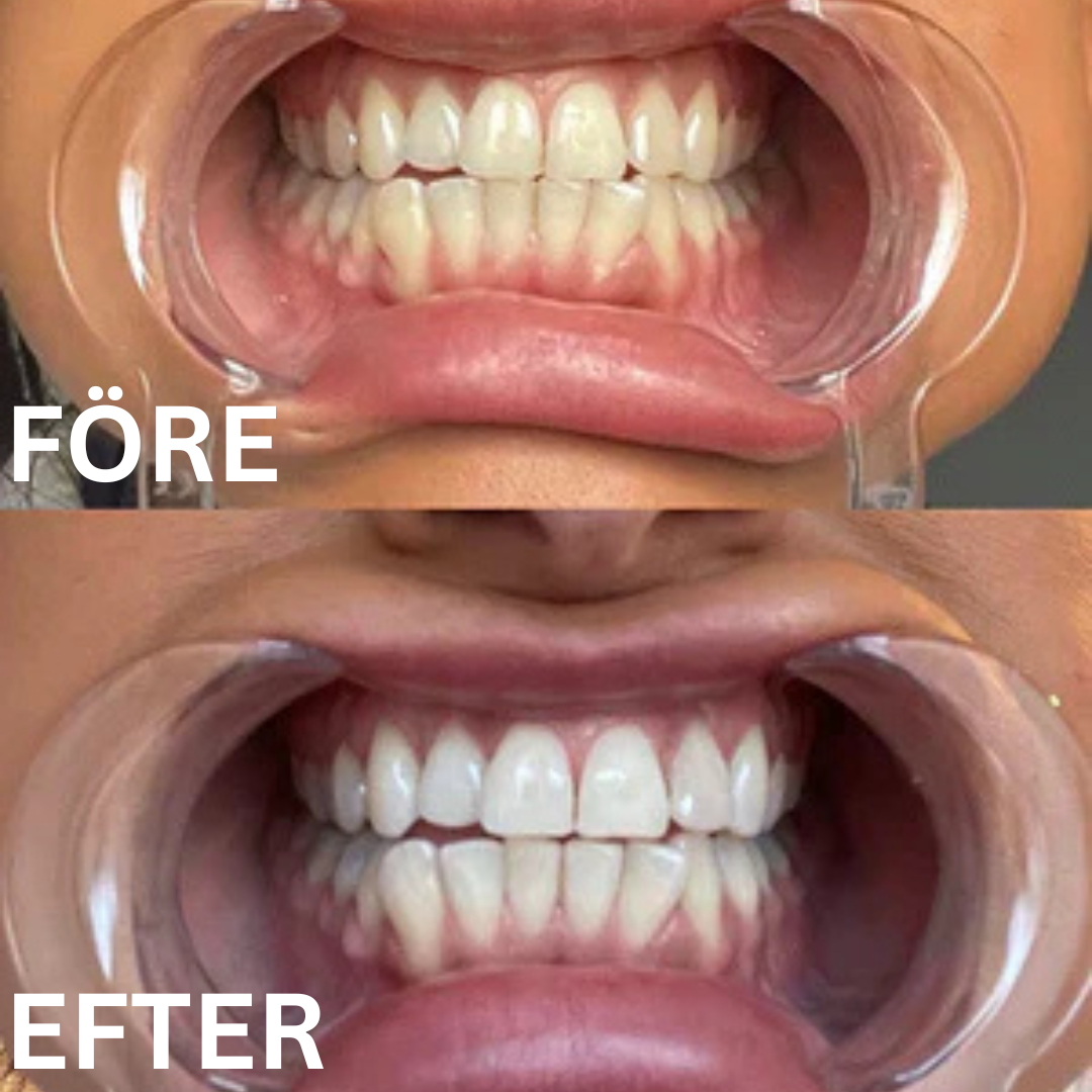 SmileSweep – Vitare leende. Fräschare andedräkt.