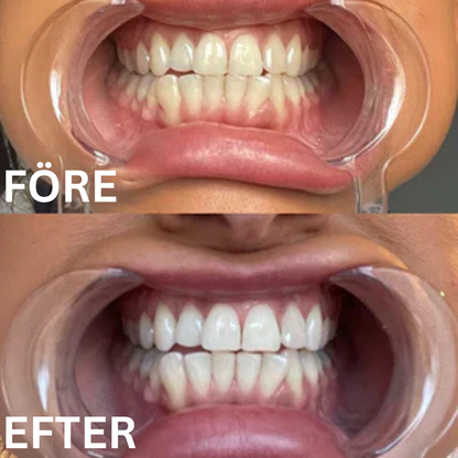 SmileSweep – Vitare leende. Fräschare andedräkt.